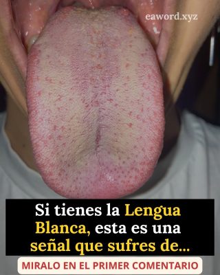 Lengua blanca: qué es por qué aparece y como cuidarla.