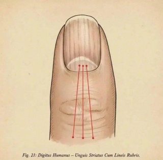 LÍNEAS EN LAS UÑAS Y CONSEJOS PARA SOLUCIONARLO