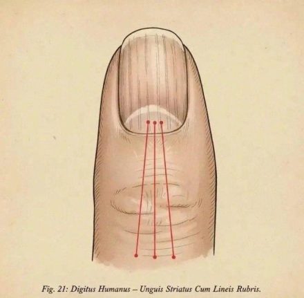LÍNEAS EN LAS UÑAS Y CONSEJOS PARA SOLUCIONARLO
