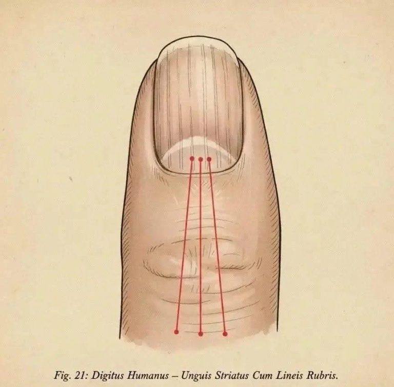LÍNEAS EN LAS UÑAS Y CONSEJOS PARA SOLUCIONARLO