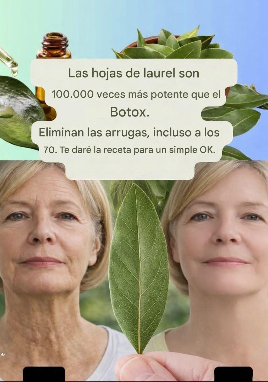 El laurel